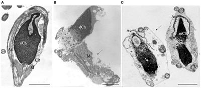 The relevance of sperm morphology in male infertility